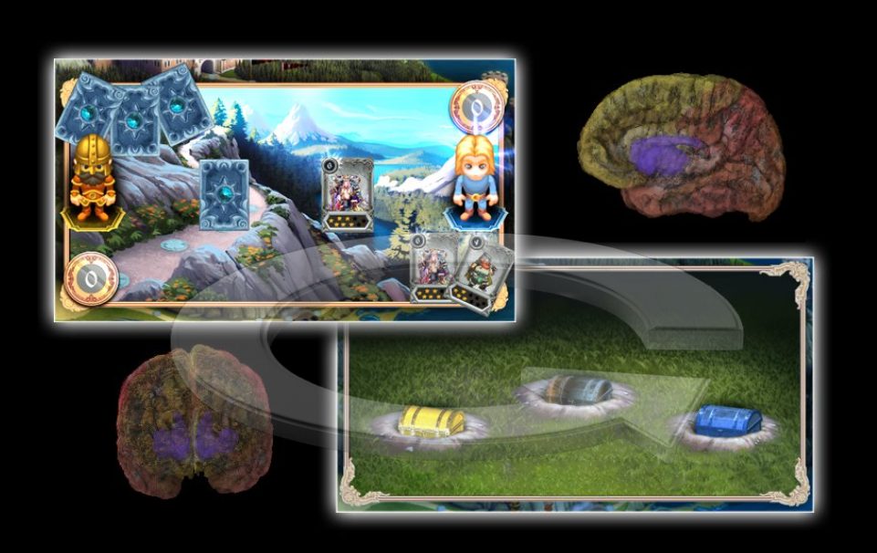 XTICS gameplay screens shown alongside brain imaging renders